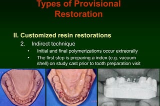 Types of Provisional
Restoration
II. Customized resin restorations
2.

Indirect technique
•
•

Initial and final polymerizations occur extraorally
The first step is preparing a index (e.g. vacuum
shell) on study cast prior to tooth preparation visit

 
