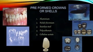 Provisional restoration