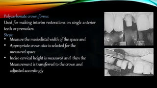 Provisional restoration