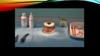 Provisional restoration