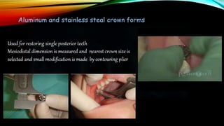 Provisional restoration