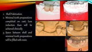 Provisional restoration