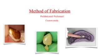 Method of Fabrication
Prefabricated/ Preformed.
Custom made.
 