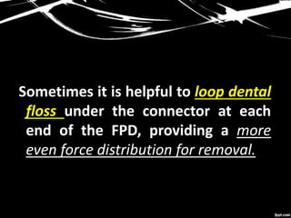 Sometimes it is helpful to loop dental
floss under the connector at each
end of the FPD, providing a more
even force distribution for removal.
 