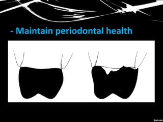 - Maintain periodontal health
 