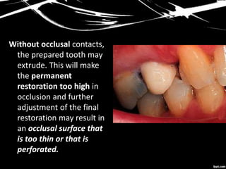 Without occlusal contacts,
the prepared tooth may
extrude. This will make
the permanent
restoration too high in
occlusion and further
adjustment of the final
restoration may result in
an occlusal surface that
is too thin or that is
perforated.
 