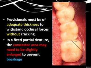 • Provisionals must be of
adequate thickness to
withstand occlusal forces
without cracking.
• In a fixed partial denture,
the connector area may
need to be slightly
enlarged to prevent
breakage
 