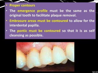 • Proper contours
• The emergence profile must be the same as the
original tooth to facilitate plaque removal.
• Embrasure areas must be contoured to allow for the
interdental papilla.
• The pontic must be contoured so that it is as self
cleansing as possible.
 