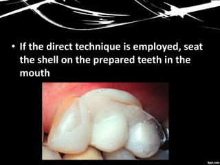 • If the direct technique is employed, seat
the shell on the prepared teeth in the
mouth
 