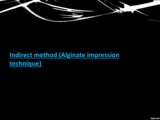 Indirect method (Alginate impression
technique)
 