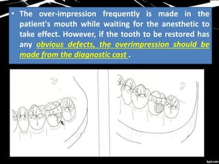 • The over-impression frequently is made in the
patient's mouth while waiting for the anesthetic to
take effect. However, if the tooth to be restored has
any obvious defects, the overimpression should be
made from the diagnostic cast .
 