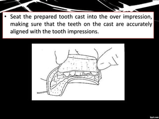 • Seat the prepared tooth cast into the over impression,
making sure that the teeth on the cast are accurately
aligned with the tooth impressions.
 
