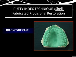 PUTTY INDEX TECHNIQUE /Shell-
Fabricated Provisional Restoration
• DIAGNOSTIC CAST
 