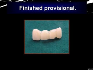 Finished provisional.
 