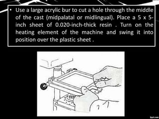• Use a large acrylic bur to cut a hole through the middle
of the cast (midpalatal or midlingual). Place a 5 x 5-
inch sheet of 0.020-inch-thick resin . Turn on the
heating element of the machine and swing it into
position over the plastic sheet .
 