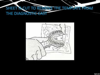 SHEET IS CUT TO REMOVE THE TEMPLATE FROM
THE DIAGNOSTIC CAST
 