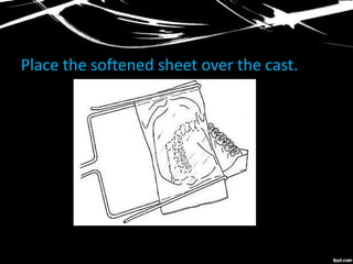 Place the softened sheet over the cast.
 