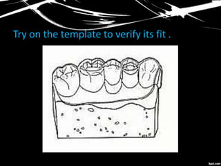Try on the template to verify its fit .
 