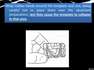 Wrap rubber bands around the template and cast, being
careful not to place them over the abutment
preparations, lest they cause the template to collapse
in that area .
 