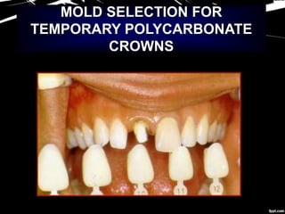 MOLD SELECTION FOR
TEMPORARY POLYCARBONATE
CROWNS
 