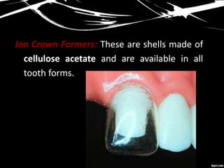 Ion Crown Formers: These are shells made of
cellulose acetate and are available in all
tooth forms.
 