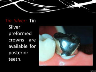 Tin Silver: Tin
Silver
preformed
crowns are
available for
posterior
teeth.
 
