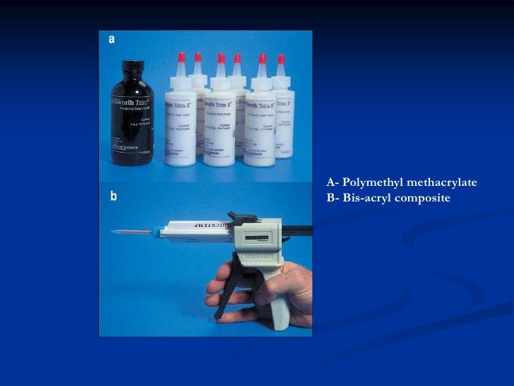 Provisional restorations