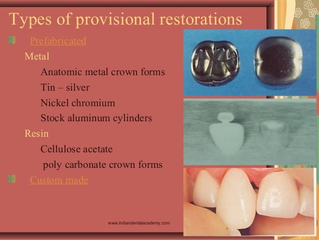 Provisional Restorations Provisional Restorations