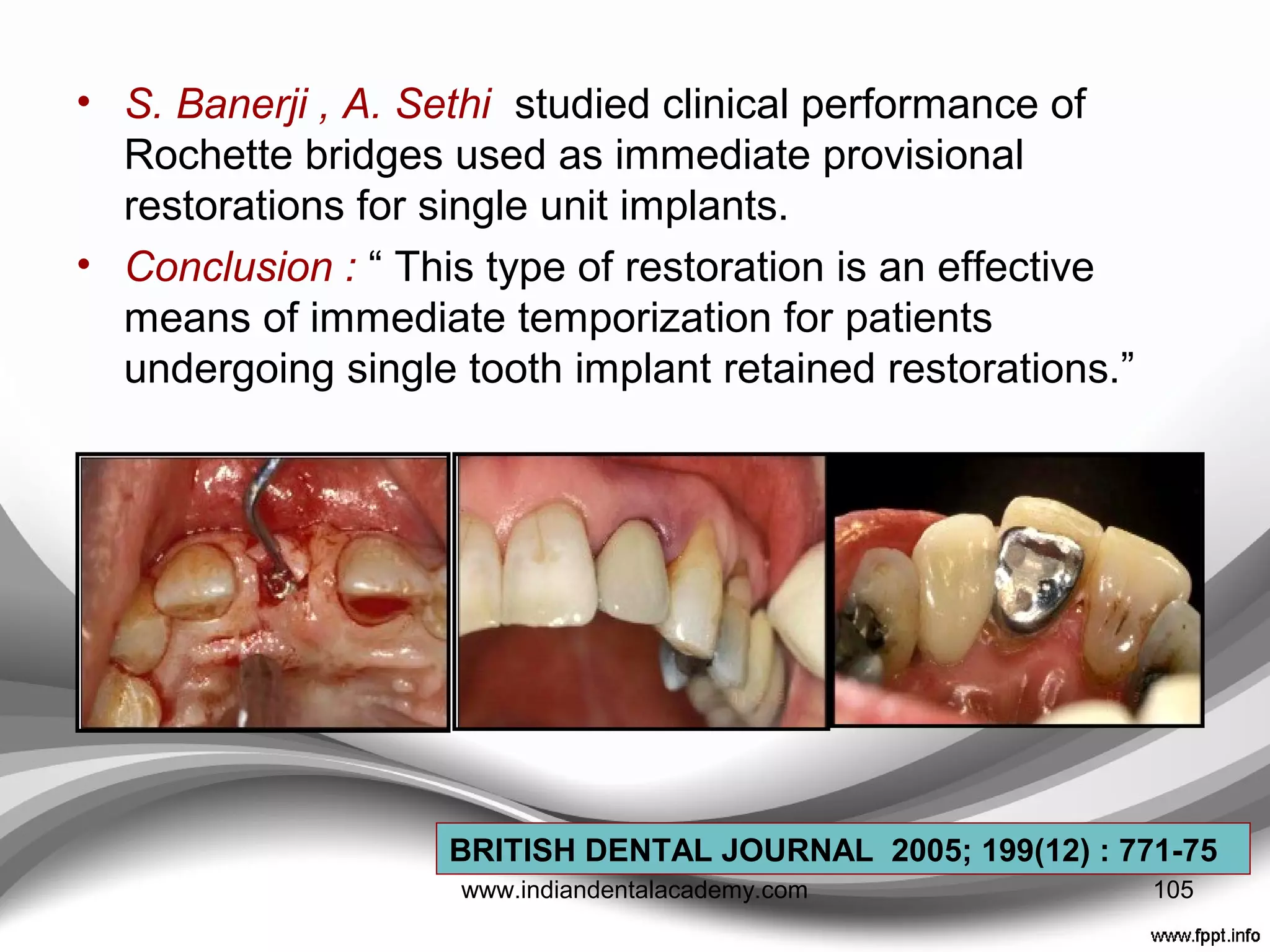 • Stefan Holst and Priv-Doz ---- studied The effect of
provisional restoration material type on micromovement
of implants
• Concluded that : “The choice of material used for a
provisional restoration significantly influences the vertical
displacement of implants placed in artificial bone. When
loads are applied to distal cantilevers, load distribution
with metal reinforcement seems more favorable than
with unreinforced acrylic resin.”
J Prosthet Dent 2008;100:173-182
105www.indiandentalacademy.com
 