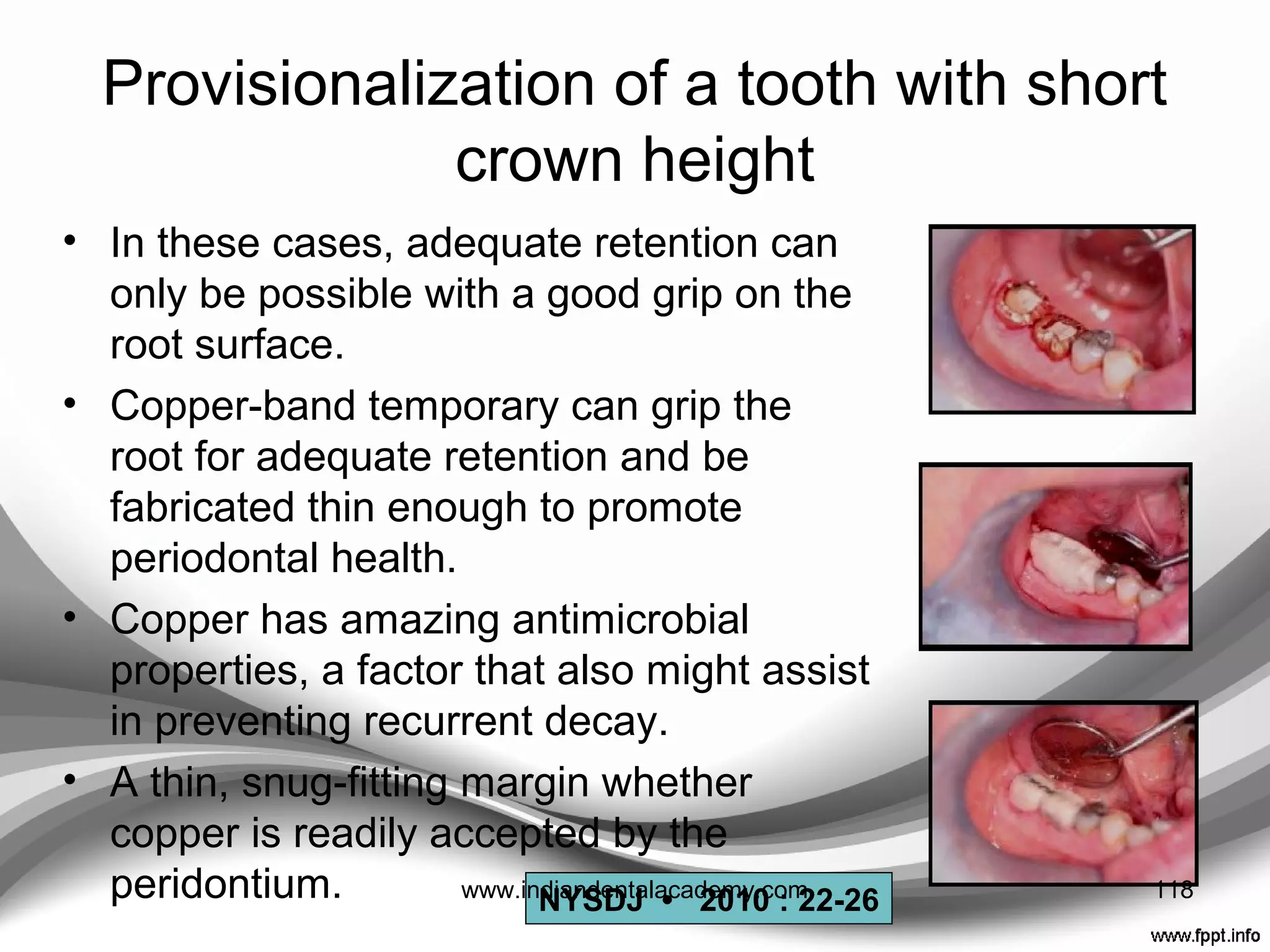 REMOVAL OF PROVISIONAL CEMENT FROM
INTAGLIO SURFACE OF CASTINGS
• Intaglio surfaces of cast restorations may be airborne-
particle abraded using 50-mm aluminum oxide
• Alternative methods ---- steam cleaning, ultrasonic, and
organic solvents. [ alcohol (ethanol),soap, chloroform,
and eucalyptus oil , Solitine ( containing isoparaffin
hydrocarbon oil & lanolin ]
118www.indiandentalacademy.com
 