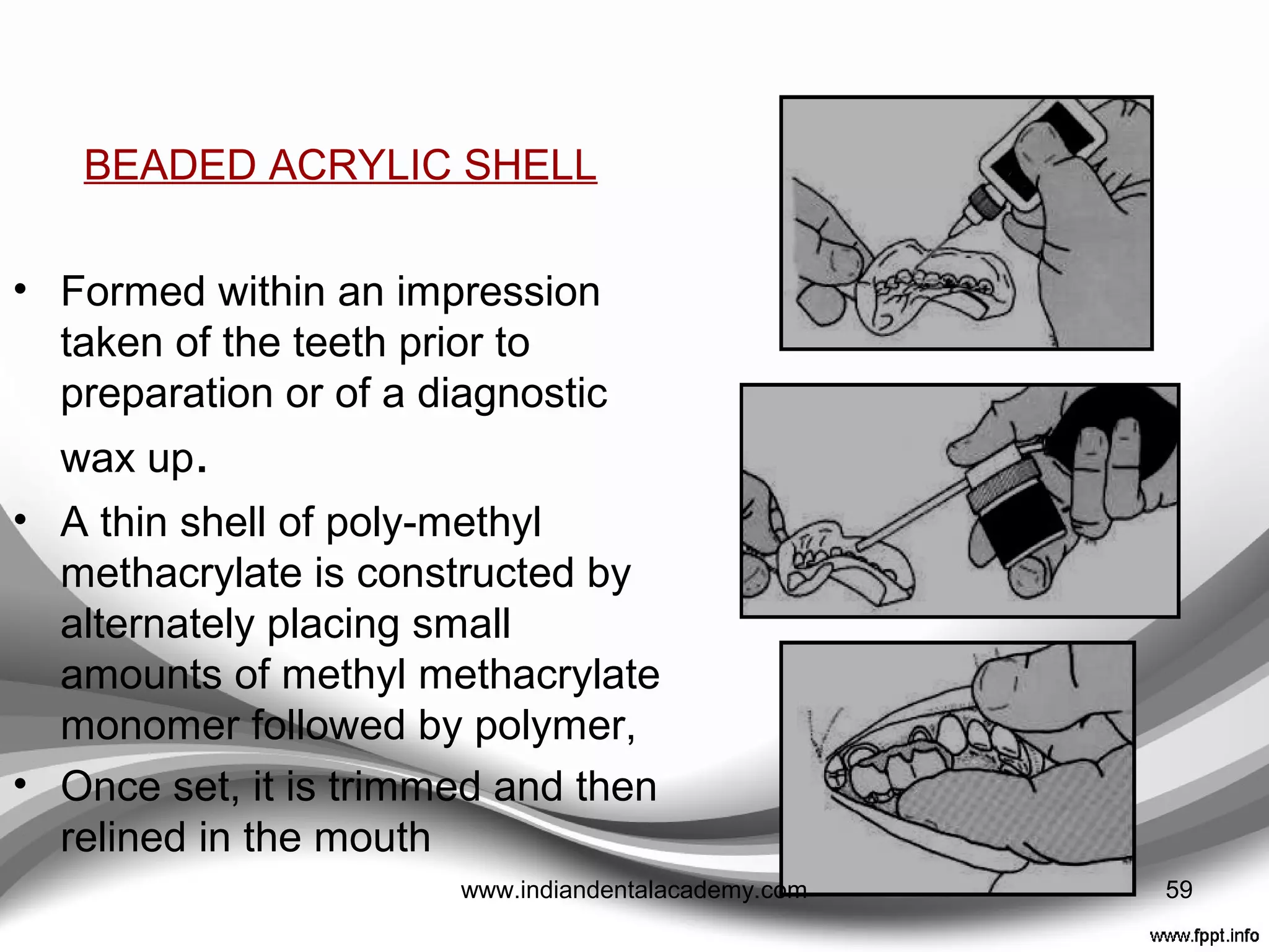 custom shells
• For multiple tooth preparations.
• Relining and careful marginal trimming are necessary
prior to fitting.
• Two types – ‘beaded acrylic’ or ‘Mill Crowns’.
• Both offer advantage of being able to use the superior
properties of poly-methyl methacrylate, whilst avoiding
pulpal damage by constructing the shell out of the
mouth.
59www.indiandentalacademy.com
 