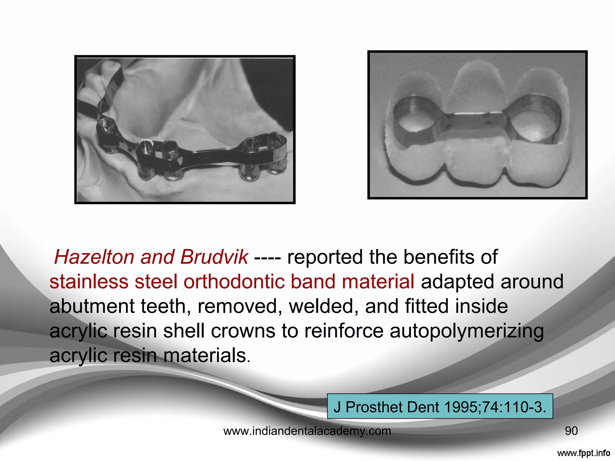 • Powell et al compared Kevlar 49 polyaramid ﬁber with
stainless steel wire , found that wire conﬁguration produced
a superior stiffness and toughness.
• Zuccari et al reported that when admixed zirconium oxide
powders were added to unﬁlled methylmethacrylate resin,
the resultant composite material exhibited significant
improvements in the modulus of elasticity, transverse
strength, toughness, and hardness
• Chee et al ---- Chilled monomer reduces transverse
strength of autopolymerizing acrylic resin by 17%
Int J Prosthodont 1994;7:81-9.
Biomed Mater Eng 1997;7:327-43.
J Prosthet Dent 1988;60:124-6. 90www.indiandentalacademy.com
 