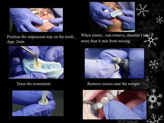 Tease the restoration
Position the impression tray on the tooth ,
App. 2min
Remove excess near the margin
When elastic , can remove, shouldn’t take
more than 6 min from mixing
 