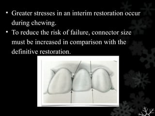 • Greater stresses in an interim restoration occur
during chewing.
• To reduce the risk of failure, connector size
must be increased in comparison with the
definitive restoration.
 