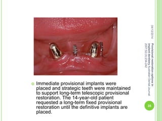  Immediate provisional implants were
placed and strategic teeth were maintained
to support long-term telescopic provisional
restoration. The 14-year-old patient
requested a long-term fixed provisional
restoration until the definitive implants are
placed.
04/12/2014
35
Provisionalrestorationoptionsin
implantdentistryAustralianDentalJournal
2007;52:(3):234-242
 