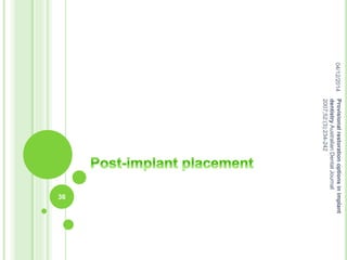 04/12/2014
36
Provisionalrestorationoptionsinimplant
dentistryAustralianDentalJournal
2007;52:(3):234-242
 