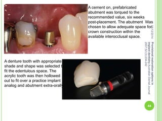 A cement on, prefabricated
abutment was torqued to the
recommended value, six weeks
post-placement. The abutment Was
chosen to allow adequate space for
crown construction within the
available interocclusal space.
A denture tooth with appropriate
shade and shape was selected to
fit the edentulous space. The
acrylic tooth was then hollowed
out to fit over a practice implant
analog and abutment extra-orally.
04/12/2014
44
Provisionalrestorationoptionsin
implantdentistryAustralianDentalJournal
2007;52:(3):234-242
 