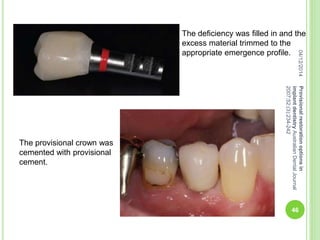 The deficiency was filled in and the
excess material trimmed to the
appropriate emergence profile.
The provisional crown was
cemented with provisional
cement.
04/12/2014
46
Provisionalrestorationoptionsin
implantdentistryAustralianDentalJournal
2007;52:(3):234-242
 