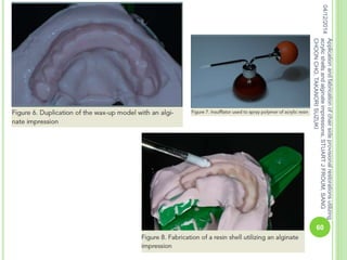 04/12/2014
60
Applicationandfabricationofchairsideprovisionalrestorationsutilizing
acrylicshellsandalginateimpressions,STUARTJFROUM,SANG
CHOONCHO,TAKANORISUZUKI
 