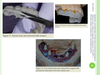 04/12/2014
62
Applicationandfabricationofchairsideprovisionalrestorations
utilizingacrylicshellsandalginateimpressions,STUARTJ
FROUM,SANGCHOONCHO,TAKANORISUZUKI
 