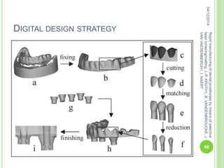 DIGITAL DESIGN STRATEGY
04/12/2014
66
Rapidmanufacturingofdentalprosthesesbymeansofselective
lasersintering/melting,J.-P.KRUTH1,B.VANDENBROUCKE,J.
VANVAERENBERGH1,I.NAERT
 