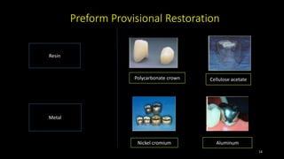 Preform Provisional Restoration
Resin
Metal
Polycarbonate crown Cellulose acetate
Nickel cromium Aluminum
Polycarbonate crown Cellulose acetate
14
 