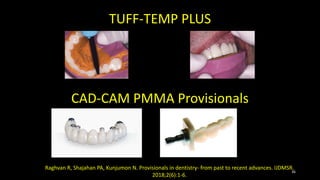 TUFF-TEMP PLUS
CAD-CAM PMMA Provisionals
Raghvan R, Shajahan PA, Kunjumon N. Provisionals in dentistry- from past to recent advances. IJDMSR.
2018;2(6):1-6.
36
 