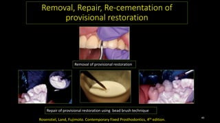 Removal, Repair, Re-cementation of
provisional restoration
Removal of provisional restoration
Repair of provisional restoration using bead brush technique
Rosenstiel, Land, Fujimoto. Contemporary Fixed Prosthodontics, 4th edition.
40
 