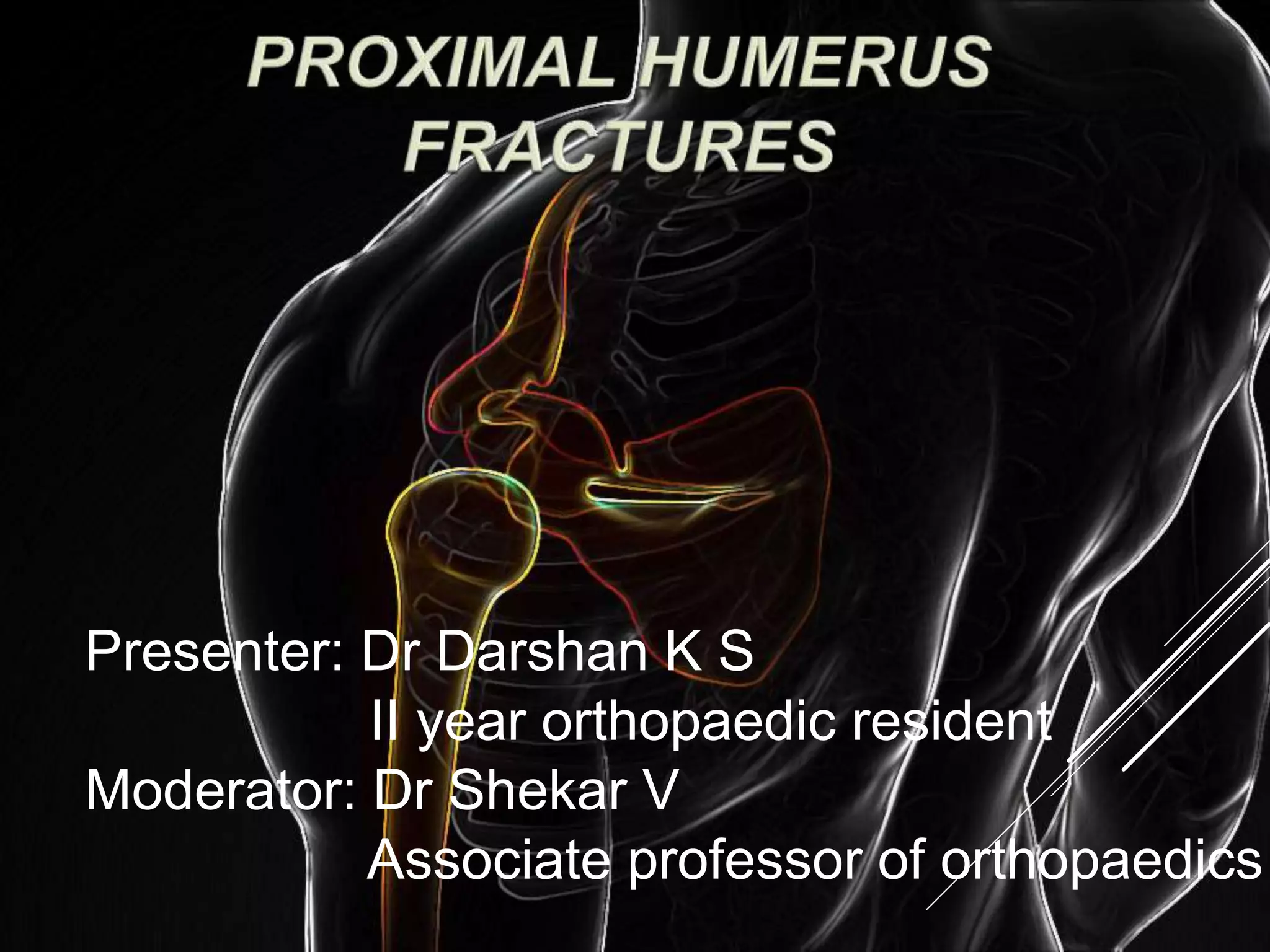 Proximal humerus fractures | PPTX