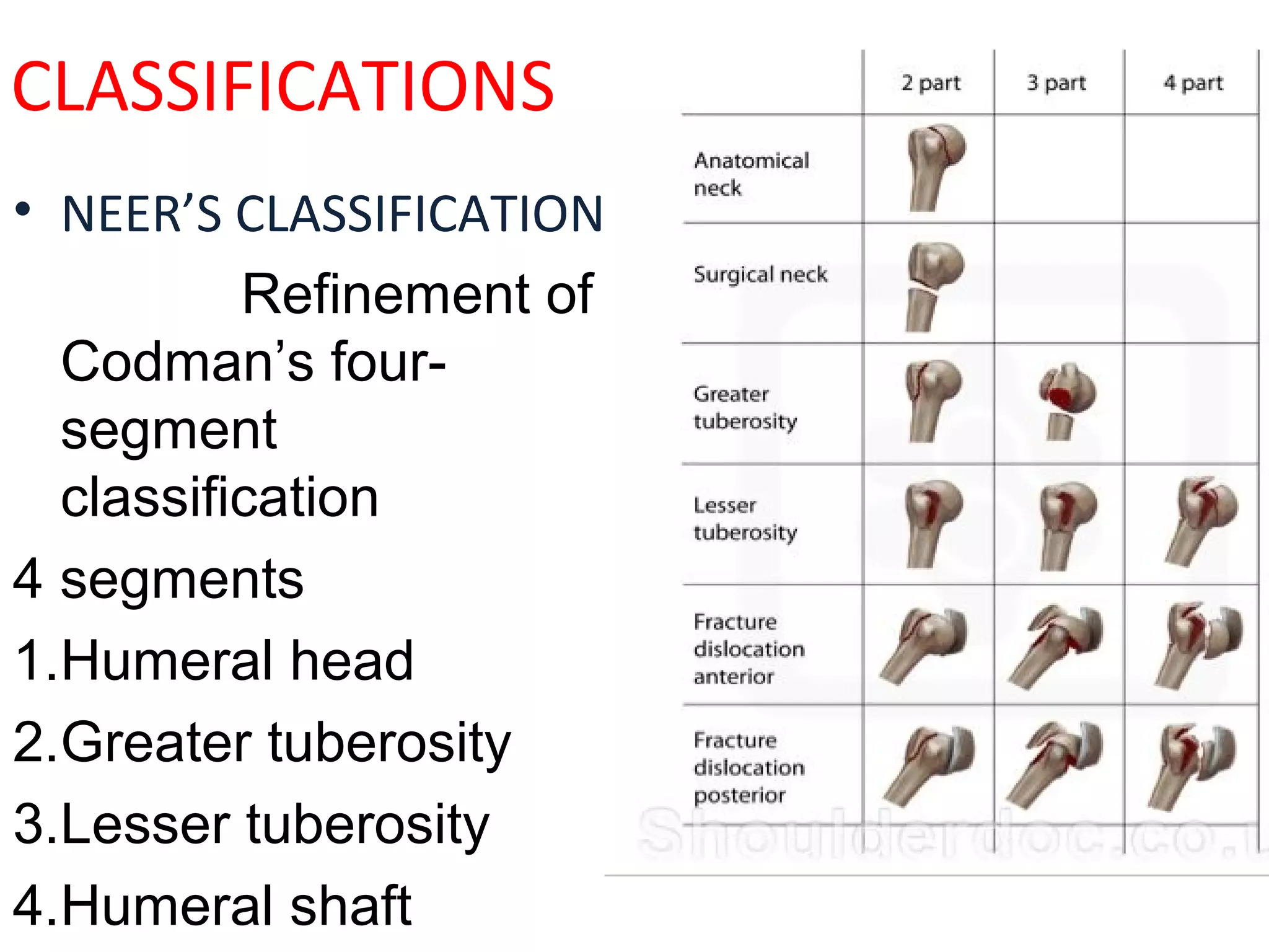 Proximal humerus-fractures | PPT
