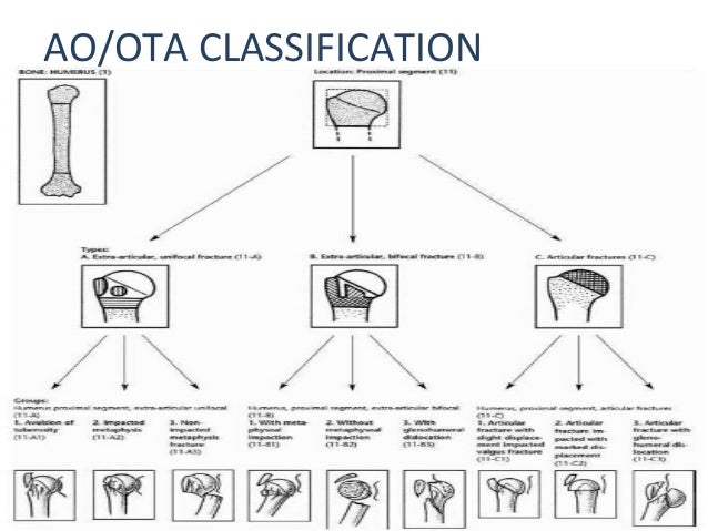 Proximal Humerus Fractures