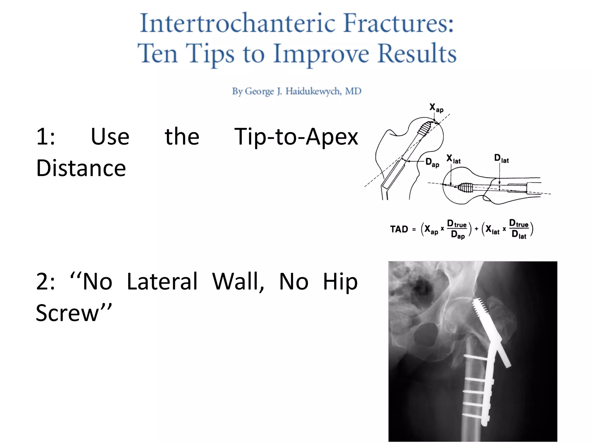 1: Use the Tip-to-Apex
Distance
2: ‘‘No Lateral Wall, No Hip
Screw’’
 
