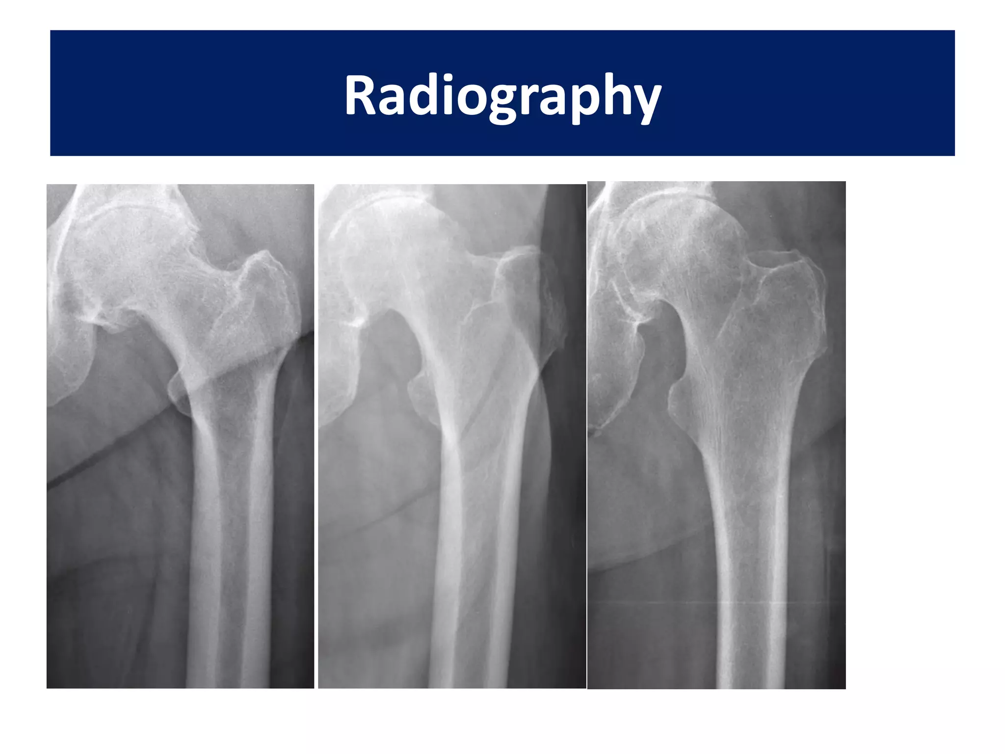 Radiography
 