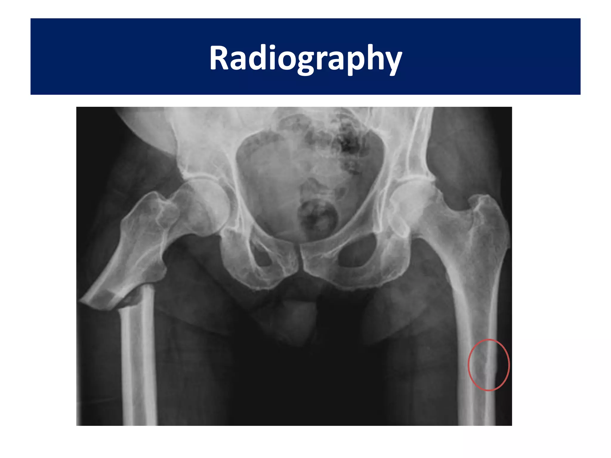Radiography
 
